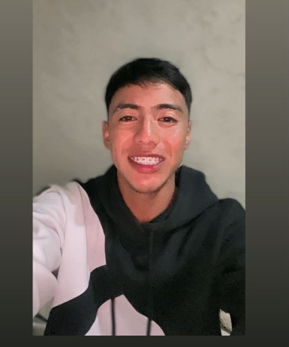 NOE